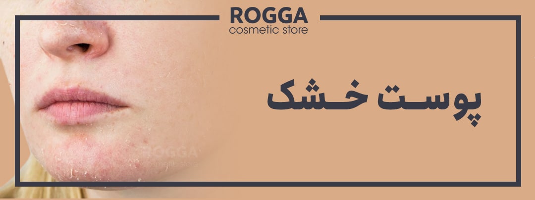 ویژگی های پوست خشک