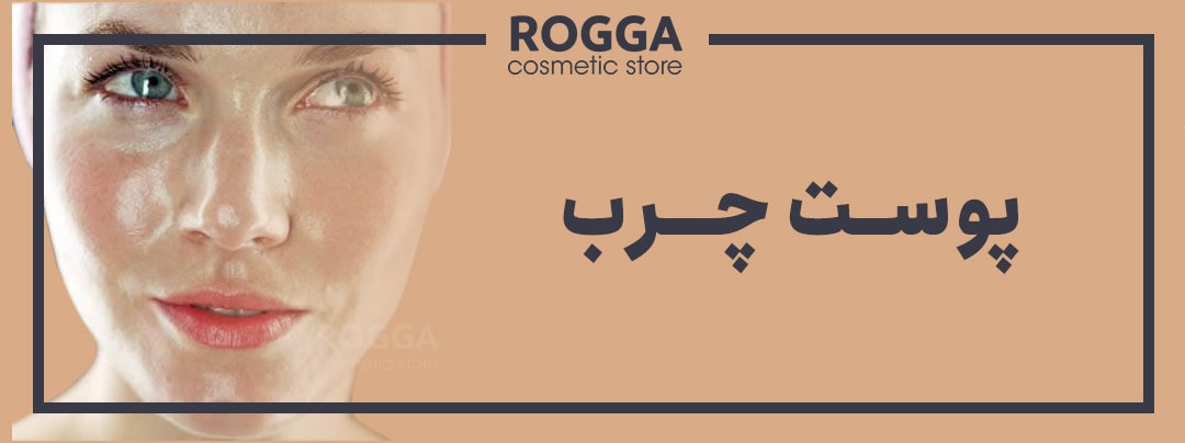 ویژگی های پوست چرب