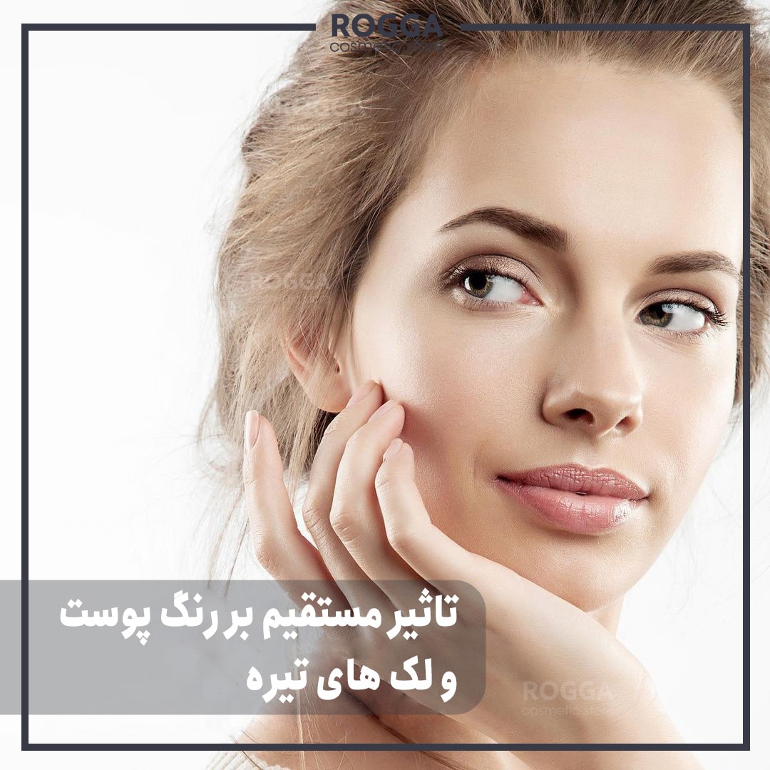 ویژگیهای ملا-کرم-اسکین-وان