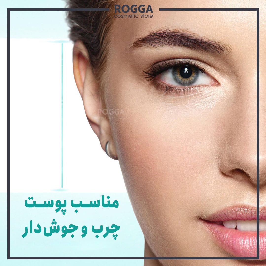 ویژگی-های-ژل-کرم-ضد-جوش-6-در-1-اسکین-وان