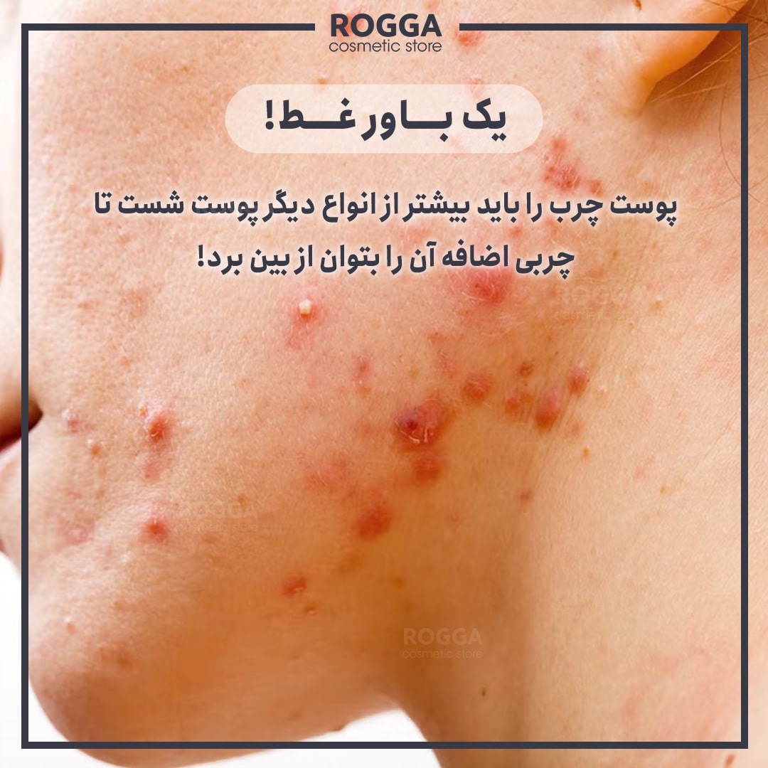 باورهای غلط پوست چرب-رگا شاپ