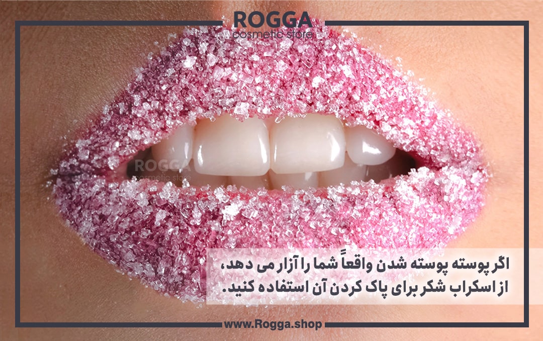 اگر پوسته پوسته شدن واقعاً شما را آزار می دهد، از اسکراب شکر برای پاک کردن آن استفاده کنید