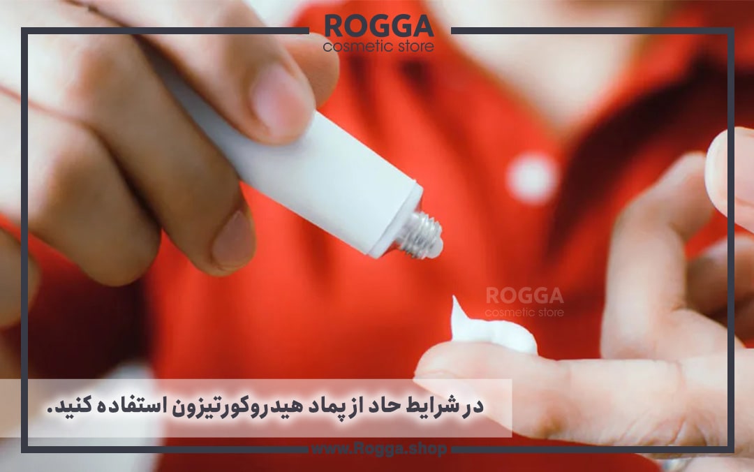 در شرایط حاد از پماد هیدروکورتیزون استفاده کنید
