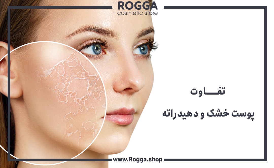 تفاوت پوست خشک و دهیدراته