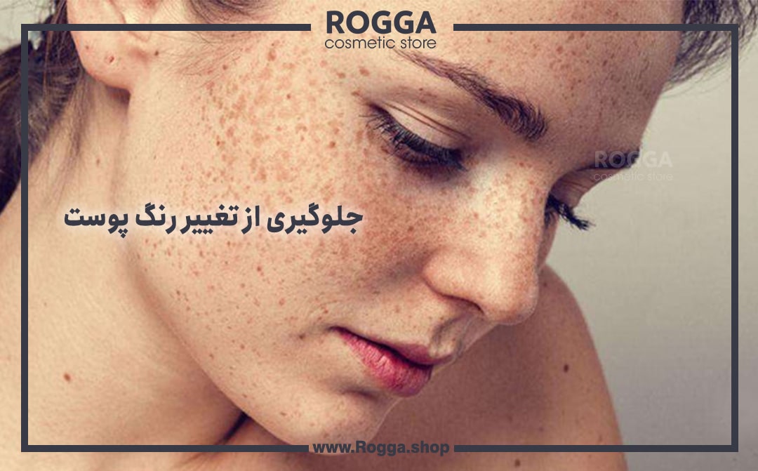 جلوگیری از تغییر رنگ پوست