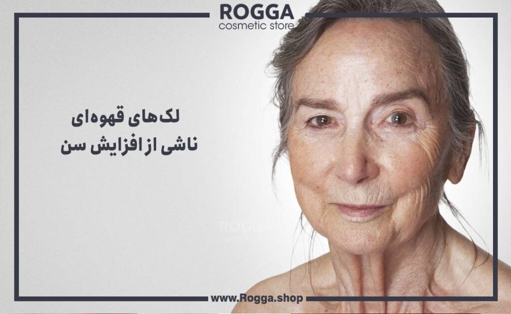 لک‌های قهوه‌ای
