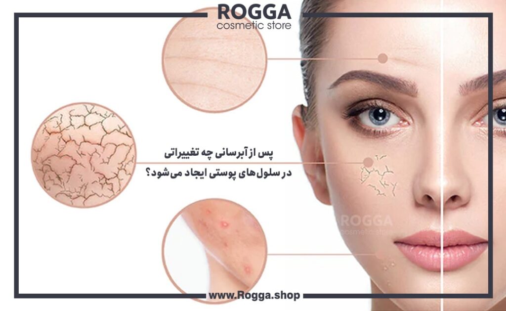 پس از آبرسانی چه تغییراتی
