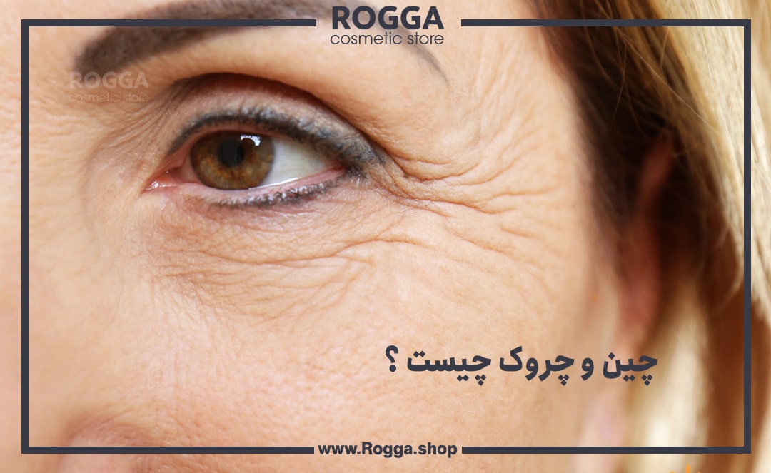 چین و چروک چیست ؟