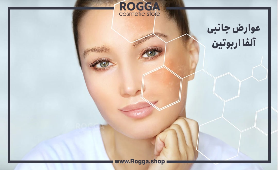عوارض-جانبی-آلفا-اربوتین