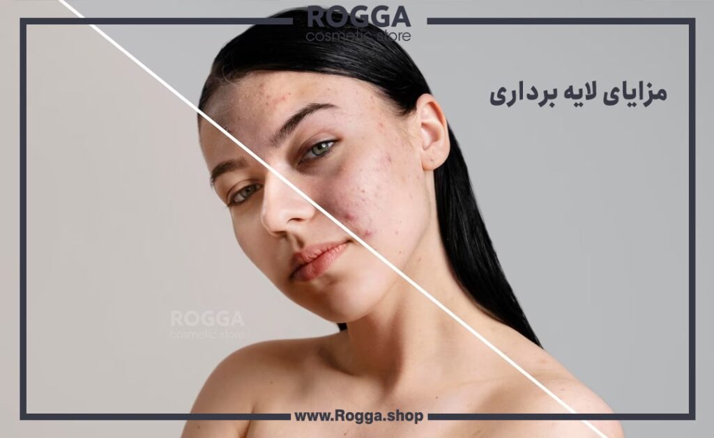 مزایای-لایه-برداری-