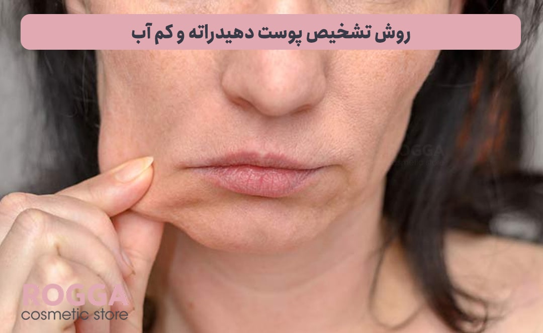 روش-تشخیص-پوست-دهیدراته-و-کم-آب-