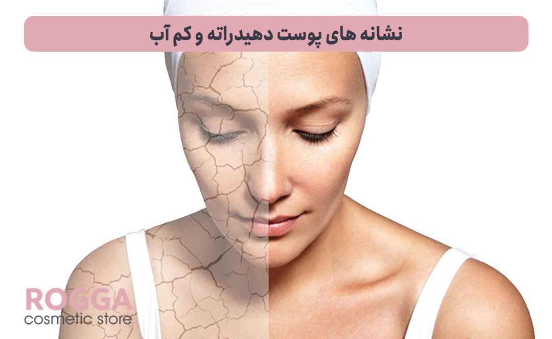 نشانه-های-پوست-دهیدراته-و-کم-آب-min