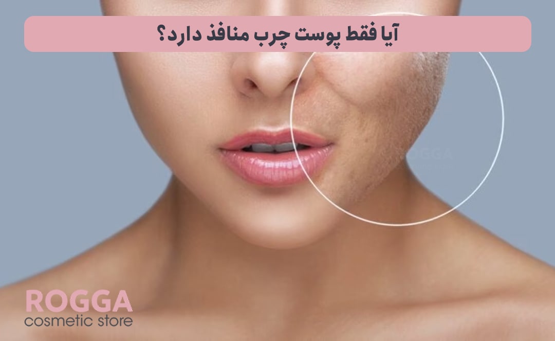 آیا-فقط-پوست-چرب-منافذ-دارد؟