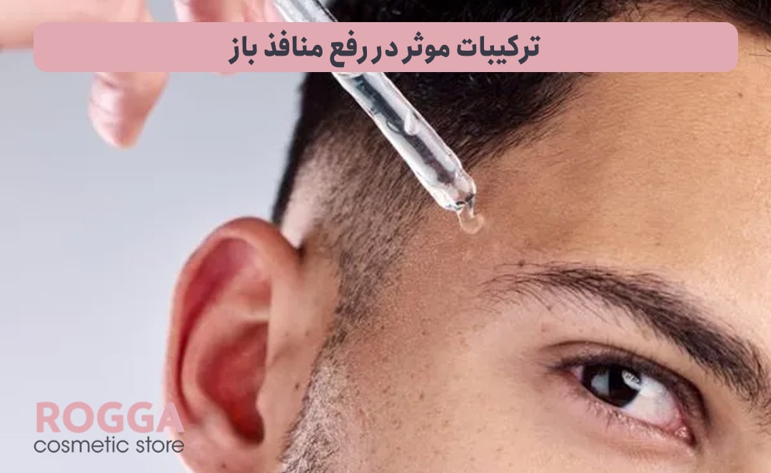 ترکیبات-موثر-در-رفع-منافذ-باز