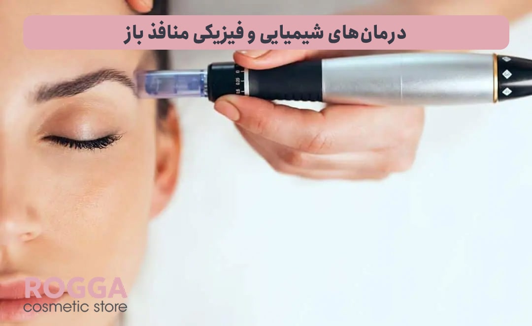 درمان‌های-شیمیایی-و-فیزیکی-منافذ-باز
