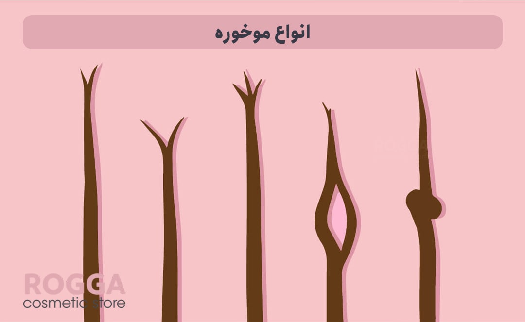 انواع-موخوره